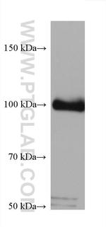 PLA2G4A Antibody in Western Blot (WB)