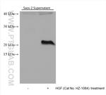 IL-11 Antibody in Western Blot (WB)