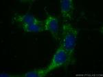 TSPO Antibody in Immunocytochemistry (ICC/IF)