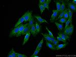 ECH1 Antibody in Immunocytochemistry (ICC/IF)