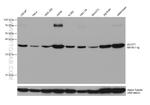 ACOT7 Antibody in Western Blot (WB)