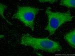 MYL6 Antibody in Immunocytochemistry (ICC/IF)