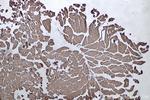 MYL6 Antibody in Immunohistochemistry (Paraffin) (IHC (P))