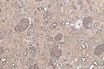 MYL6 Antibody in Immunohistochemistry (Paraffin) (IHC (P))