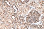 MYL6 Antibody in Immunohistochemistry (Paraffin) (IHC (P))