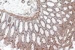 MYL6 Antibody in Immunohistochemistry (Paraffin) (IHC (P))