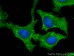 ARPC2 Antibody in Immunocytochemistry (ICC/IF)