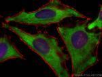 EEF1G Antibody in Immunocytochemistry (ICC/IF)