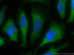 STIP1 Antibody in Immunocytochemistry (ICC/IF)