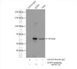 STIP1 Antibody in Immunoprecipitation (IP)