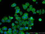 TCEB1 Antibody in Immunocytochemistry (ICC/IF)