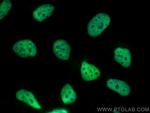 U2AF2 Antibody in Immunocytochemistry (ICC/IF)