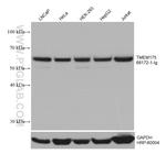 TMEM175 Antibody in Western Blot (WB)