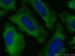 PPA1 Antibody in Immunocytochemistry (ICC/IF)