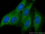 PSMB2 Antibody in Immunocytochemistry (ICC/IF)