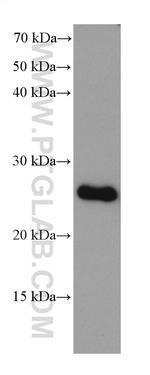 PSMB2 Antibody in Western Blot (WB)