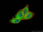 NSFL1C Antibody in Immunocytochemistry (ICC/IF)