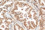 NSFL1C Antibody in Immunohistochemistry (Paraffin) (IHC (P))