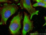 TCP1 Antibody in Immunocytochemistry (ICC/IF)