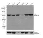 TCP1 Antibody in Western Blot (WB)