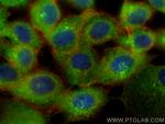 CAPZB Antibody in Immunocytochemistry (ICC/IF)