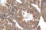 CAPZB Antibody in Immunohistochemistry (Paraffin) (IHC (P))