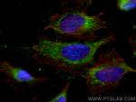 NNT Antibody in Immunocytochemistry (ICC/IF)