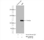 NNT Antibody in Immunoprecipitation (IP)