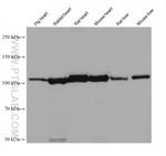 NNT Antibody in Western Blot (WB)