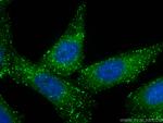 APPL1 Antibody in Immunocytochemistry (ICC/IF)