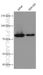 APPL1 Antibody in Western Blot (WB)