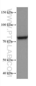 APPL1 Antibody in Western Blot (WB)