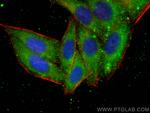 VPS25 Antibody in Immunocytochemistry (ICC/IF)