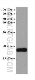 VPS25 Antibody in Western Blot (WB)