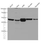 CYP2S1 Antibody in Western Blot (WB)