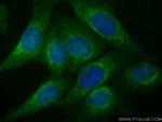 ARF4 Antibody in Immunocytochemistry (ICC/IF)