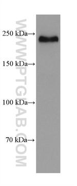 NOTCH2/NOTCH2NL Antibody in Western Blot (WB)