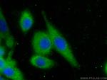 eRF3a/GSPT1 Antibody in Immunocytochemistry (ICC/IF)