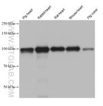 ACTN2 Antibody in Western Blot (WB)