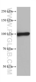 ACTN2 Antibody in Western Blot (WB)