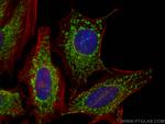 IMMT Antibody in Immunocytochemistry (ICC/IF)