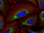 IMMT Antibody in Immunocytochemistry (ICC/IF)