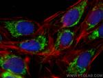 HIGD1A Antibody in Immunocytochemistry (ICC/IF)