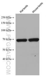 TTC30A Antibody in Western Blot (WB)