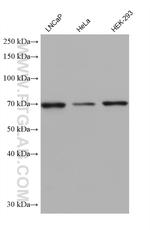 TTC30A Antibody in Western Blot (WB)