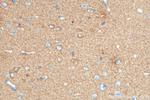 DCLK1 Antibody in Immunohistochemistry (Paraffin) (IHC (P))