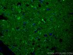 DCLK1 Antibody in Immunohistochemistry (PFA fixed) (IHC (PFA))