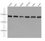 KIAA1429 Antibody in Western Blot (WB)