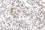 HNRNPD Antibody in Immunohistochemistry (Paraffin) (IHC (P))