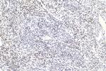 HNRNPD Antibody in Immunohistochemistry (Paraffin) (IHC (P))